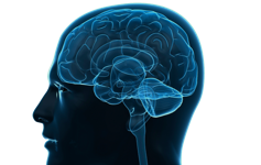TBI brain scan